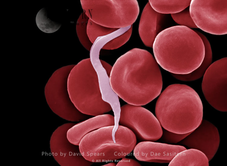 Sleeping Sickness Parasite in red blood cells