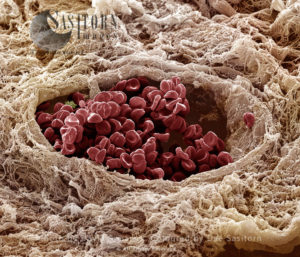 Human vein showing red blood cells