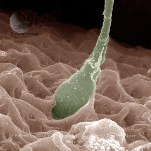 Human sperm fertilizing egg (ovum) 