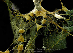 Nerve cells grown in a culture