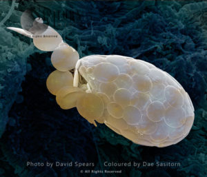 Amoeba protective shell 'test'