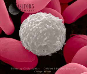 SEM: Human White and Red Blood Cells; Magnification x 21,000 for A4 size print
