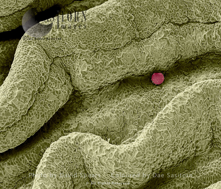 SEM: Human Ovum in Fallopian Tube : Magnification x 1,000 for A4 size print