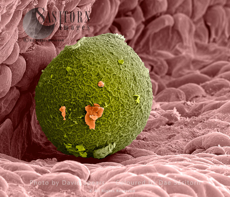 SEM: Human Ovum in Fallopian Tube : Magnification x 1,000 for A4 size print