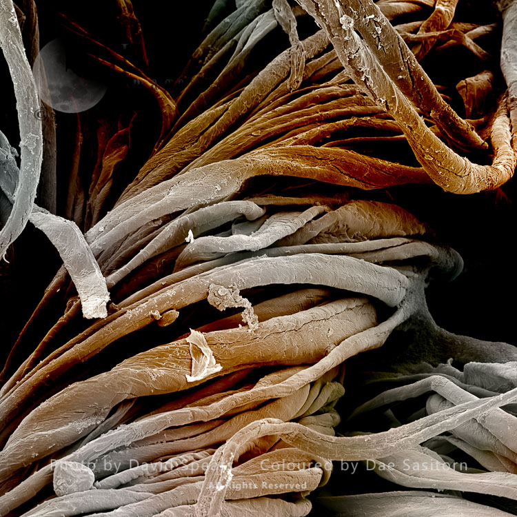 Scanning Electron Micrograph (SEM): cotton bedsheet  showing skin flakes