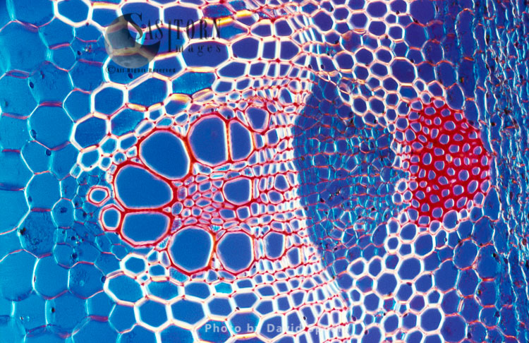 Light Micrograph (LM): A transverse section shows Vascular Bundle in Helianthus stem