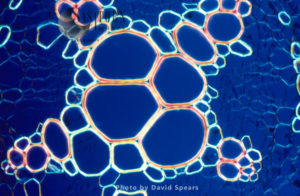 Light Micrograph (LM): A transverse section showing xylem of a root of Creeping Buttercup, (Ranunculus repens)