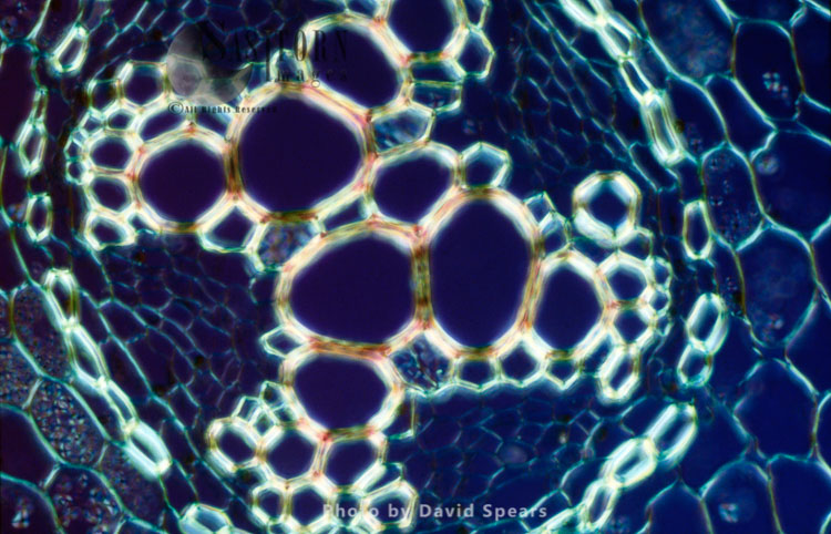Light Micrograph (LM): transverse section showing xylem of root of Ranunculus repens (Creeping Buttercup)