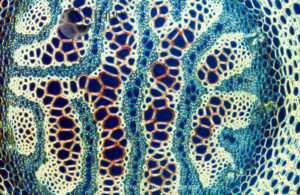 Light Micrograph (LM): A transverse section of a stem of Clubmoss(Lycopodium sp.)