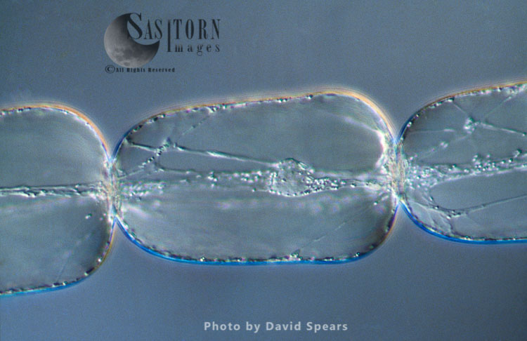 Light Micrograph (LM): Cells from a hair on the stamen of the common spiderwort (Tradescantia)