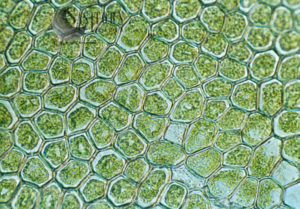 Light Micrograph (LM): The cellular struture of a non-vascular plant: Liverwort (Hepatica) showing chloroplasts and oil bodies