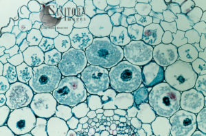 Light Micrograph (LM): Filaments of fungi Endotrophic Mycorrhiza live within cells of a root