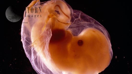 Light Micrographs: Embryo